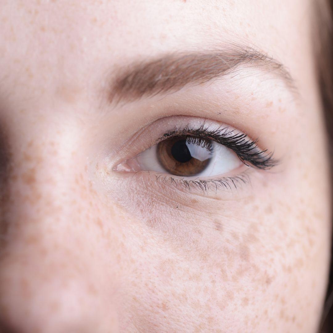 Tattooed freckles - the beauty trend of 2022