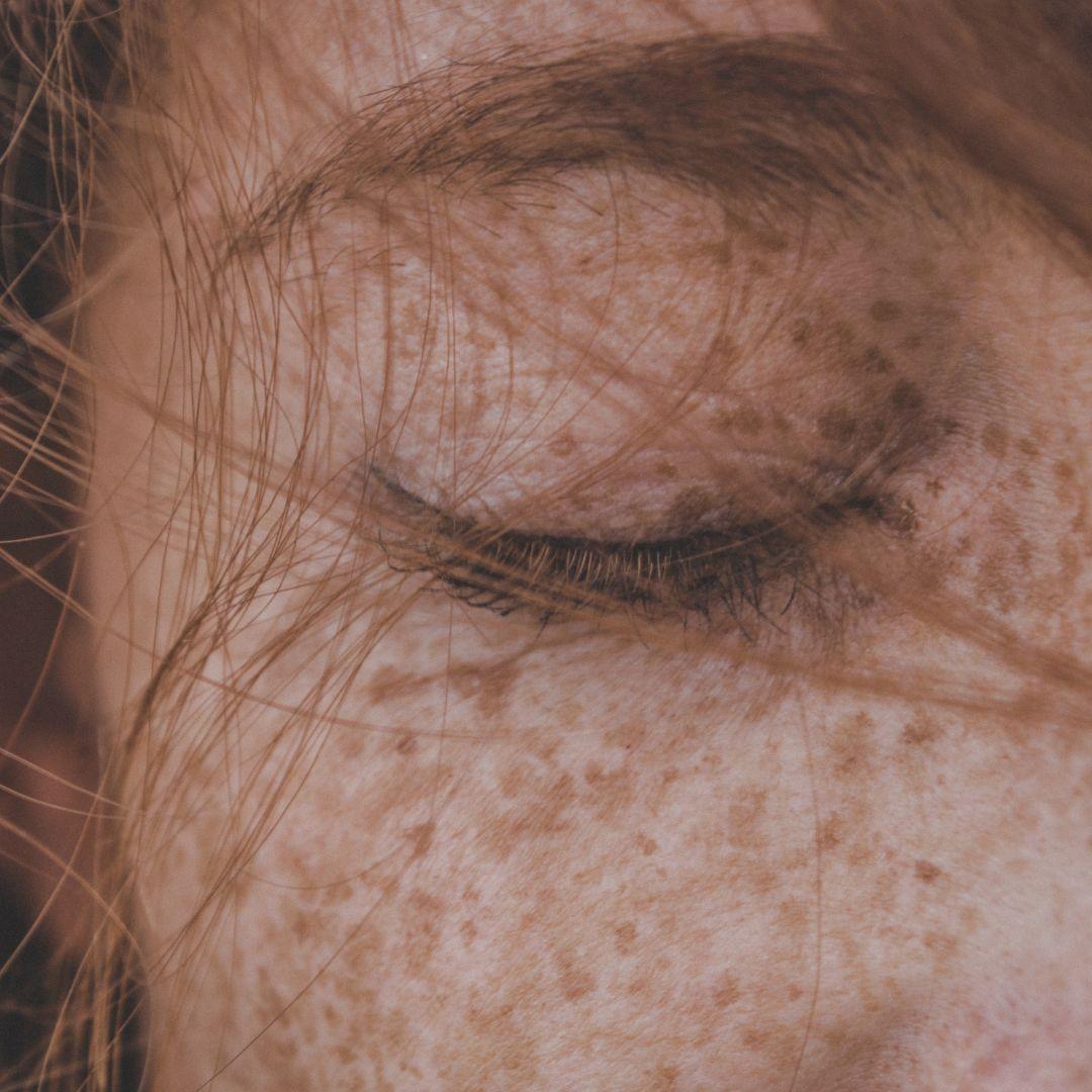 Tattooed freckles - the beauty trend of 2022